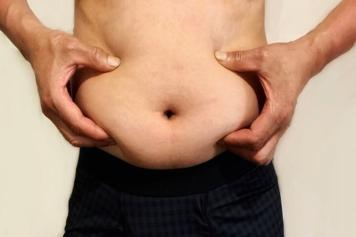 肥満なお腹